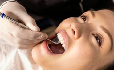 Blanqueamiento_Dental_en_Montevideo_Opciones_y_Precios